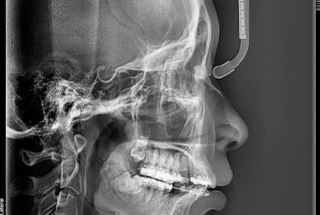 Detailed C B C T scan of patient’s head and neck