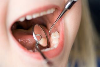 Close up of mouth receiving teeth cleaning