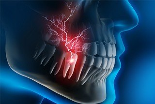 X ray diagram showing a toothache dental emergency in McKinney