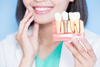 Dentist holding model of how dental implants work in McKinney