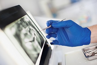 Closeup of doctor using advanced dental implant technology in McKinney