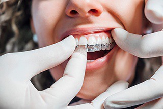 Young woman being fitted for Invisalign in McKinney