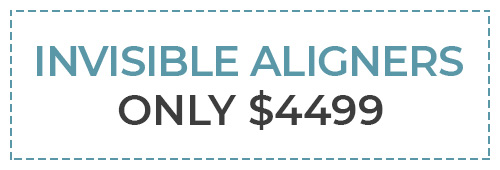 Aligners Special