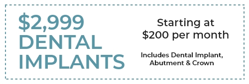 Implant special Only $3500