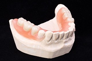 Model smile with partial denture