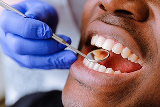 Closeup of patient's smile during dental exam