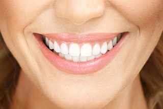 Closeup of healthy smile