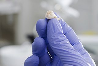 Hand holding an extracted tooth