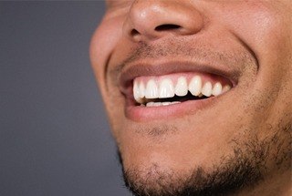 Close up of man smiling after teeth whitening in McKinney