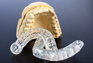 Model smile and occlusal splints