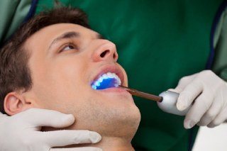 A patient receiving dental veneers