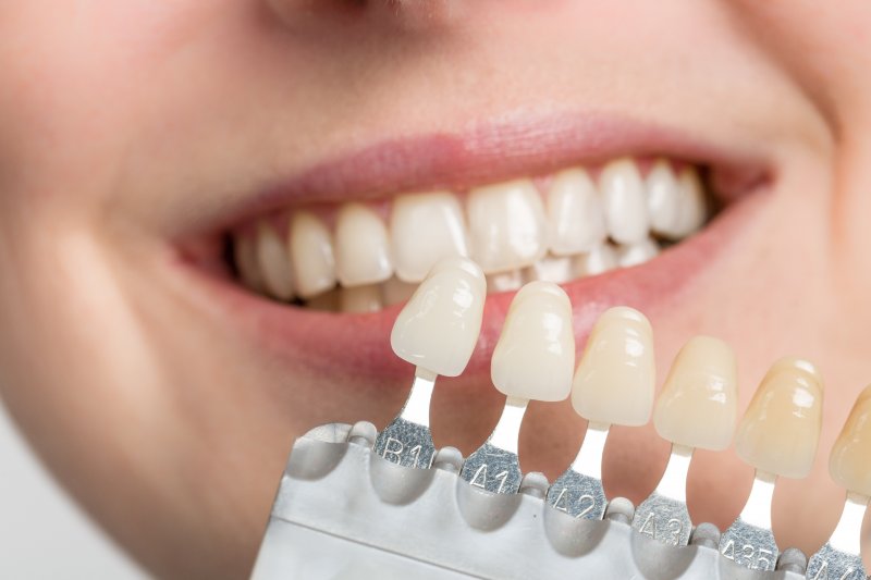 Example shades of veneers held up to a smiling woman's teeth