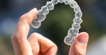 Hand holding a clear aligner