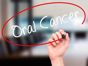Oral cancer sign