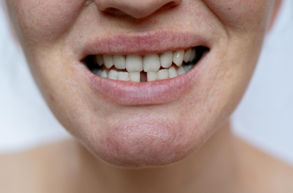 Replace Missing Teeth Seamlessly