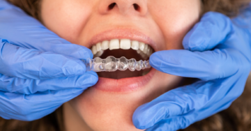 imgi 12 Invisalign McKinney Dentists