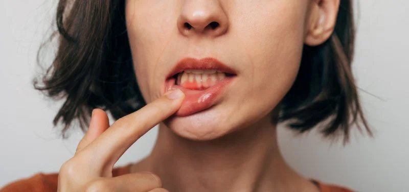Lady shows inflamed gums