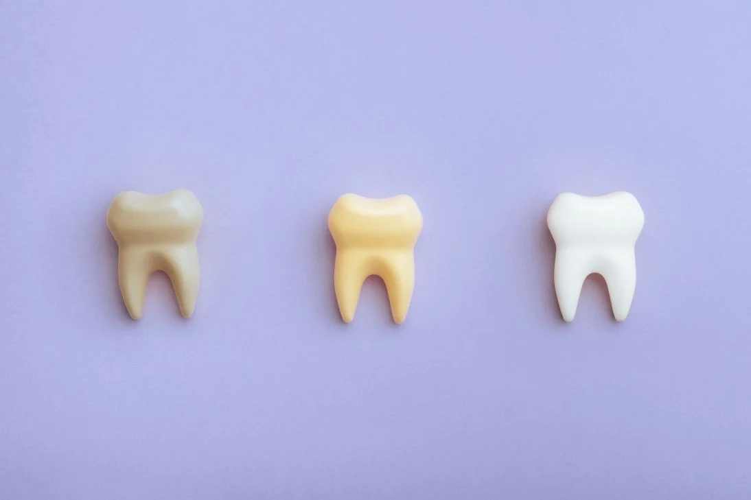 A computer-generated image of stained teeth